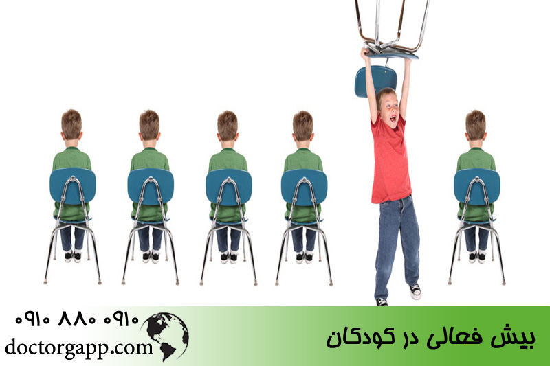بیش فعالی در کودکان