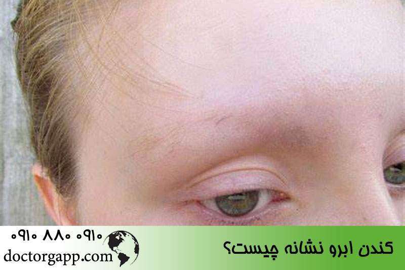 کندن ابرو نشانه چیست